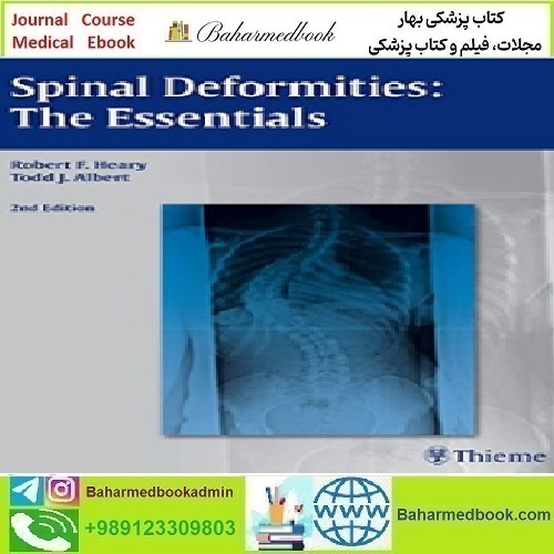 Spinal Deformities The Essentials 2014 TRUE PDF price 1€ - کتاب پزشکی بهار