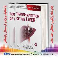 Transplantation of the Liver 3rd Edition