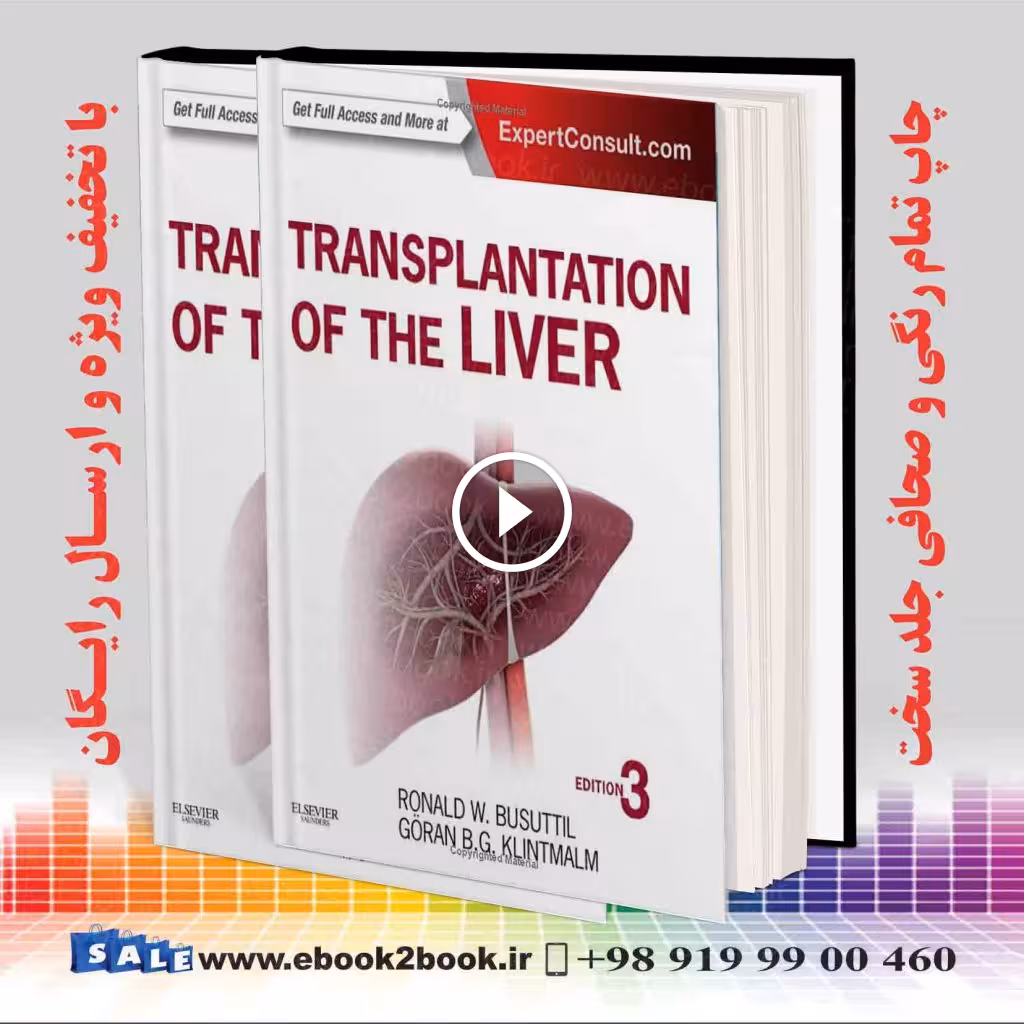Transplantation of the Liver 3rd Edition