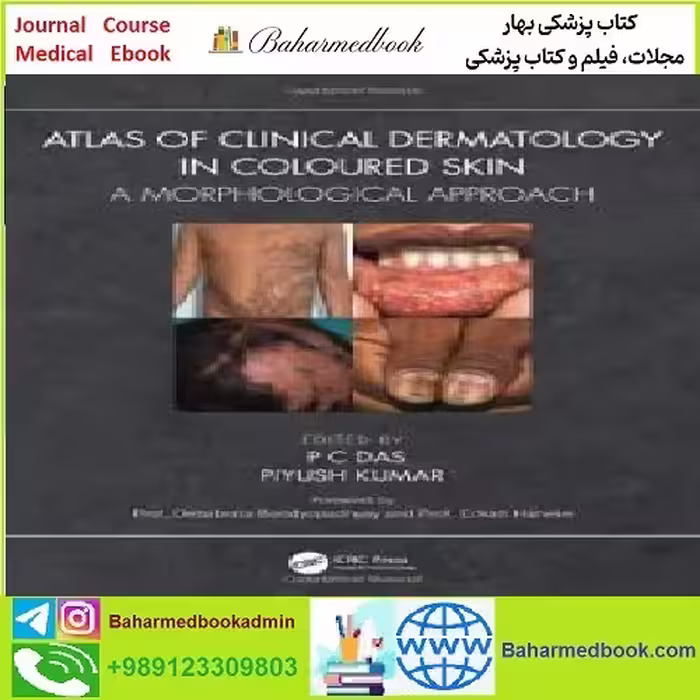 Atlas of Clinical Dermatology in Coloured Skin A Morphological A