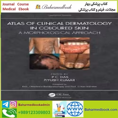 Atlas of Clinical Dermatology in Coloured Skin A Morphological A
