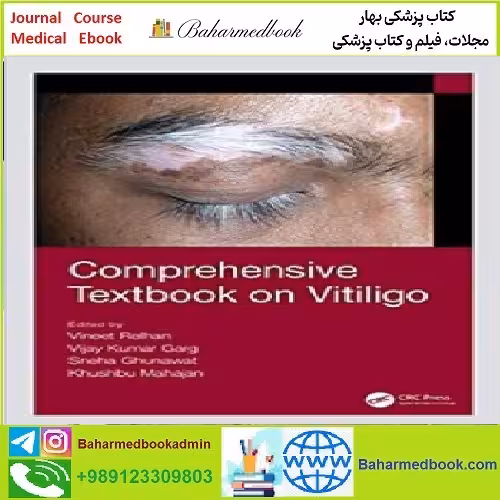 Comprehensive Textbook on Vitiligo TRUE PDF price 1€ - کتاب پزشکی بهار