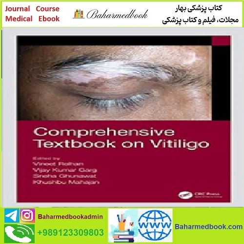 Comprehensive Textbook on Vitiligo TRUE PDF price 1€ - کتاب پزشکی بهار