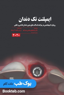 ایمپلنت تک دندان 2020 (رویکرد کم تهاجمی در مواجه با ساکت های بدون دندان قدامی و خلفی)