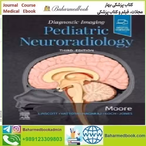 Diagnostic Imaging Pediatric Neuroradiology 2020 T