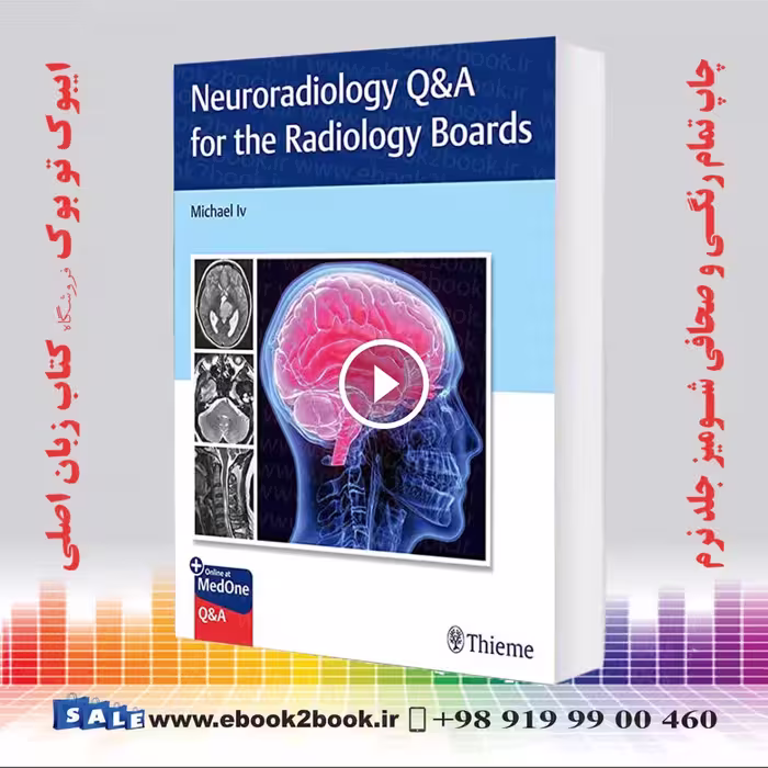 Neuroradiology QandA for the Radiology Boards