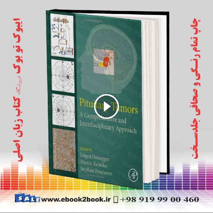 Pituitary Tumors: A Comprehensive and Interdisciplinary Approach