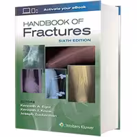 کتاب Handbook of Fractures اثر جمعی از نویسندگان انتشارات لیپین کات