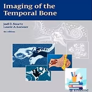 Imaging of the Temporal Bone TRUE PDF price 1€