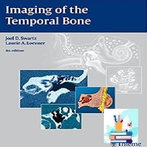 Imaging of the Temporal Bone TRUE PDF price 1€