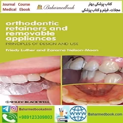 Orthodontic Retainers and Removable Appliances Principles of D