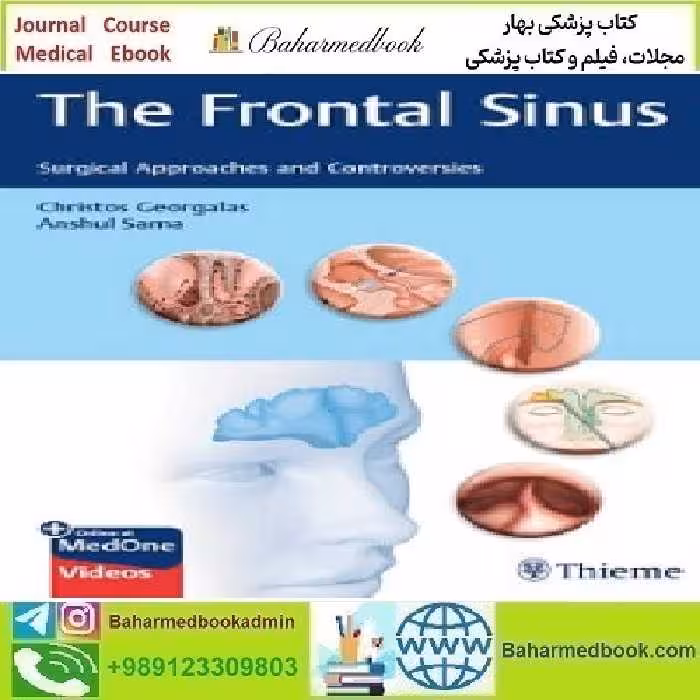 The Frontal Sinus Surgical Approaches and Controversies 202