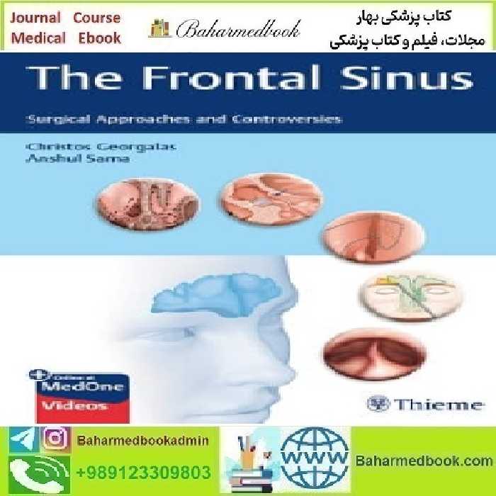 The Frontal Sinus Surgical Approaches and Controversies 202