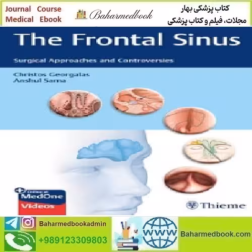 The Frontal Sinus Surgical Approaches and Controversies 202