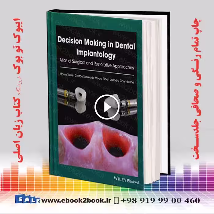 Decision Making in Dental Implantology