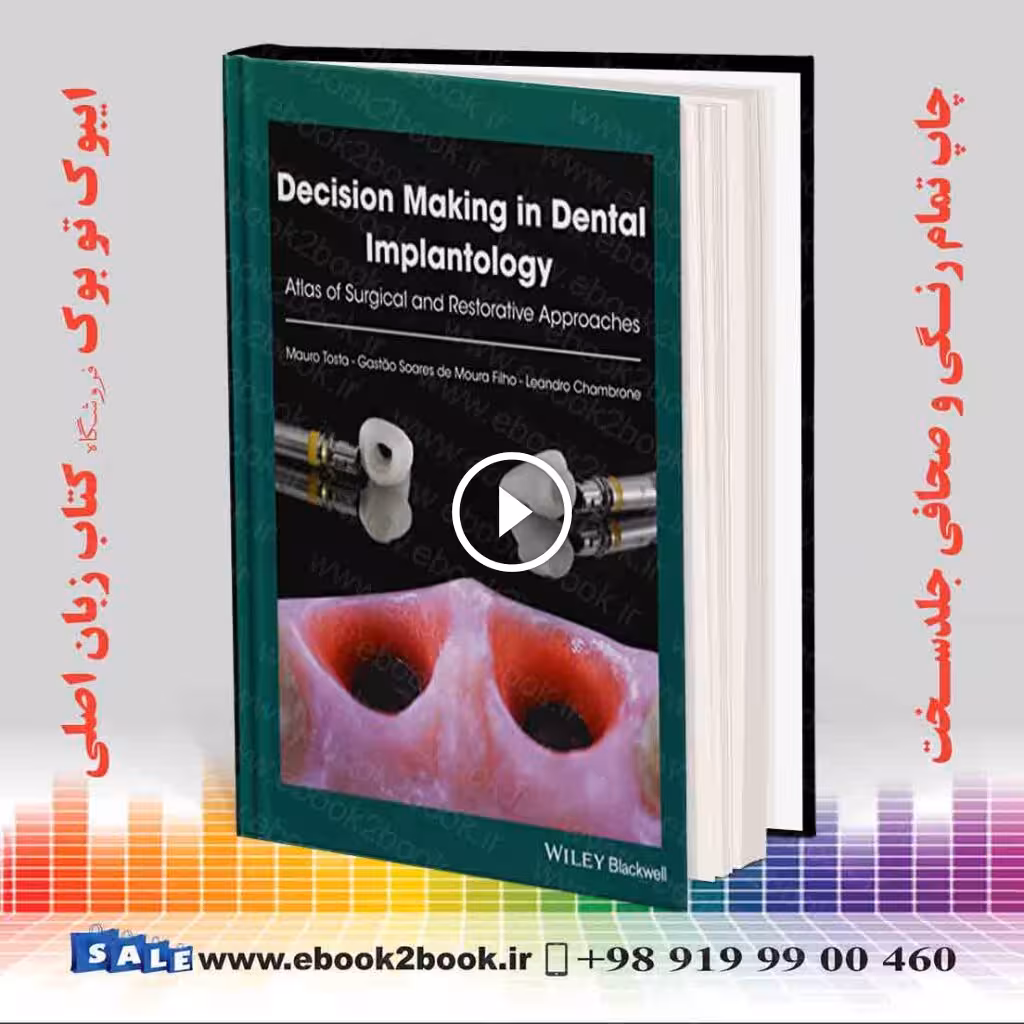 Decision Making in Dental Implantology