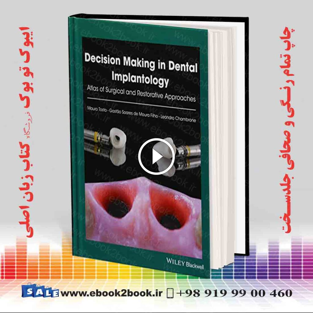 Decision Making in Dental Implantology