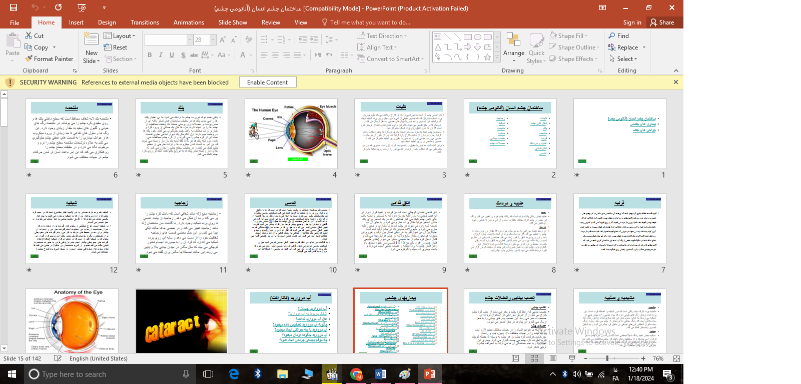 پاورپوینت ساختمان چشم انسان (آناتومي چشم)