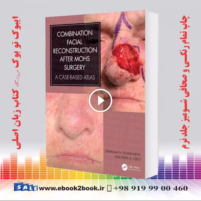 Combination Facial Reconstruction after Mohs Surgery