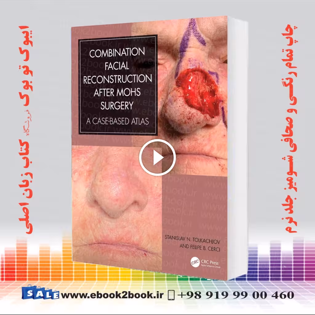 Combination Facial Reconstruction after Mohs Surgery