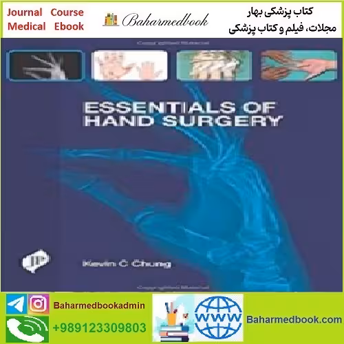 Essentials of Hand Surgery TRUE PDF price 1€ - کتاب پزشکی بهار