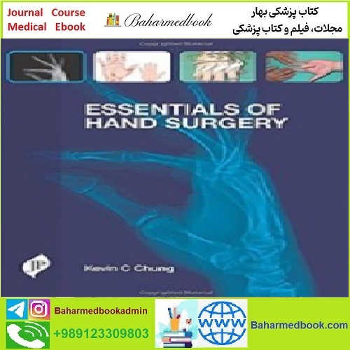 Essentials of Hand Surgery TRUE PDF price 1€ - کتاب پزشکی بهار