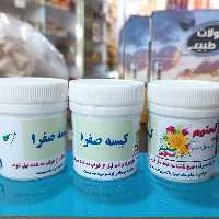 کیسه صفرا (پولیپ کیسه صفرا ، سنگ کیسه صفرا )