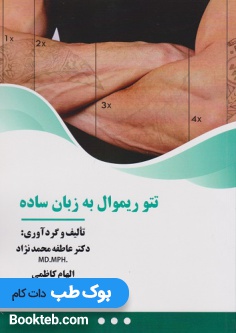 تتو ریموال به زبان ساده