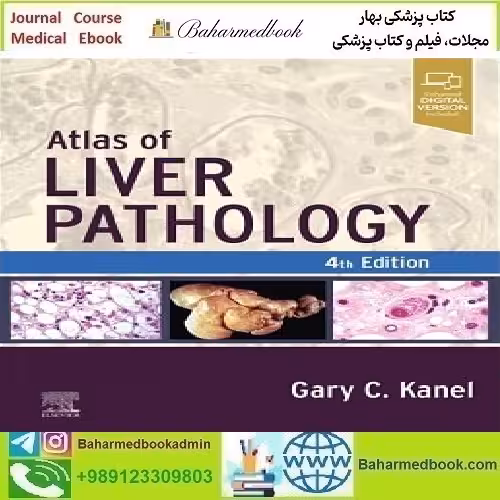 Atlas of Liver Pathology 2024 TRUE PDF price 3€ - کتاب پزشکی بهار