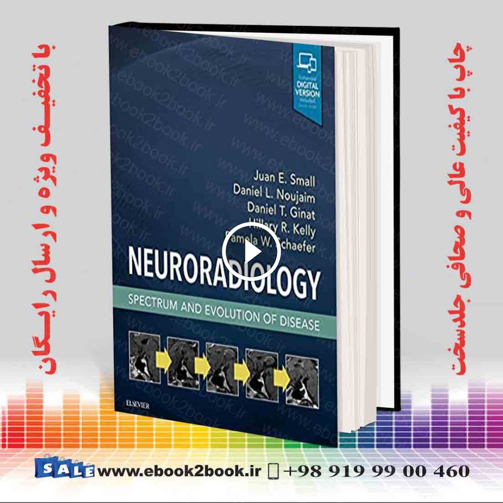 Neuroradiology: Spectrum and Evolution of Disease