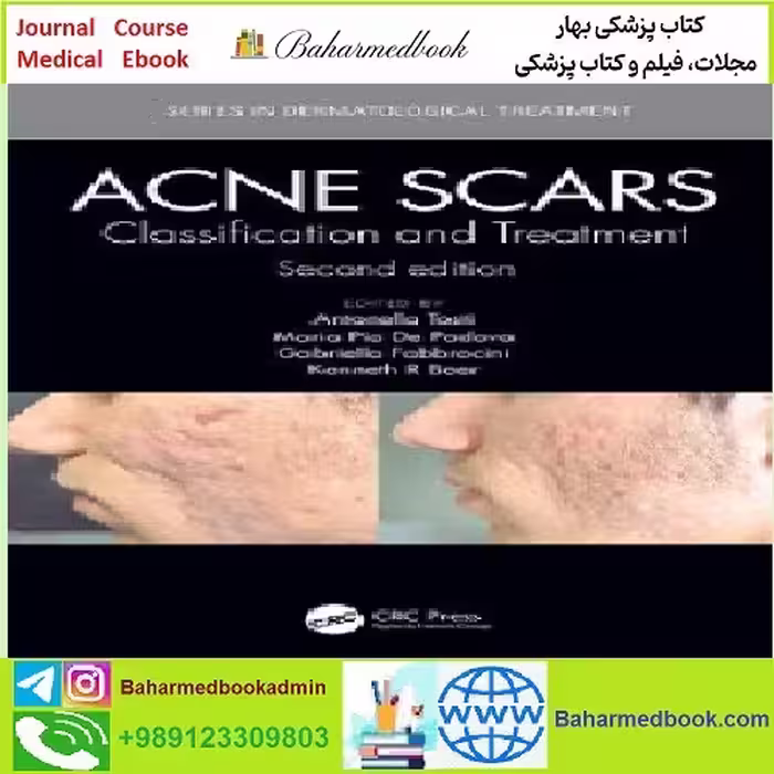 Acne Scars TRUE PDF price 1€