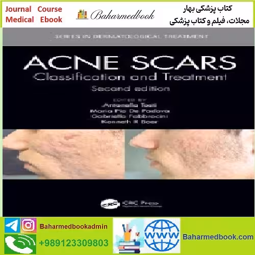 Acne Scars TRUE PDF price 1€