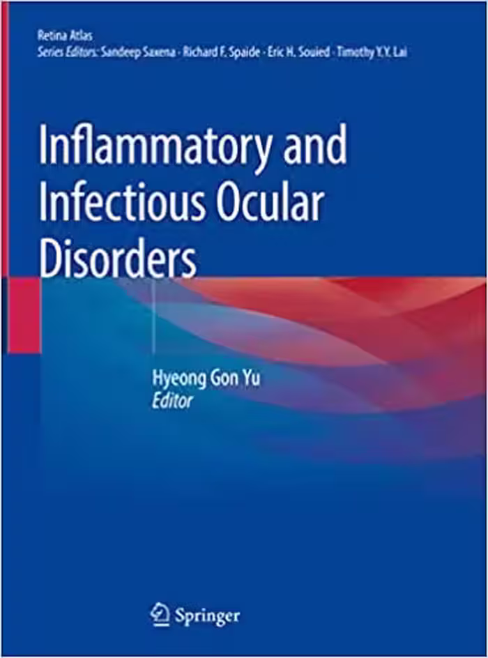 󾕇 دانلود کتاب Inflammatory And Infectious Ocular Disorders, 2019 - دانلود کتاب های دانشگاهی