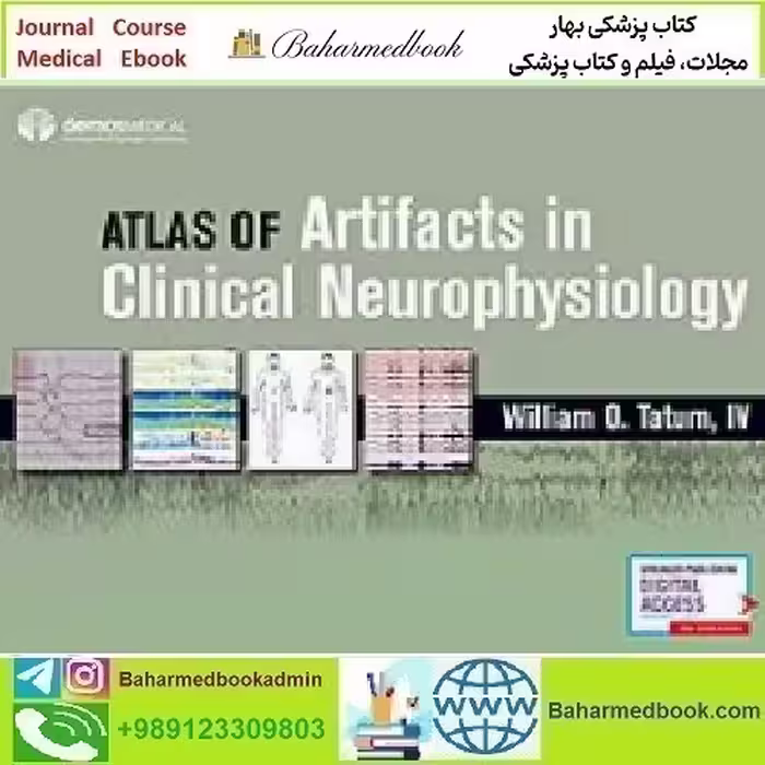 Atlas of Artifacts in Clinical Neurophysiology 2019 TRUE PD