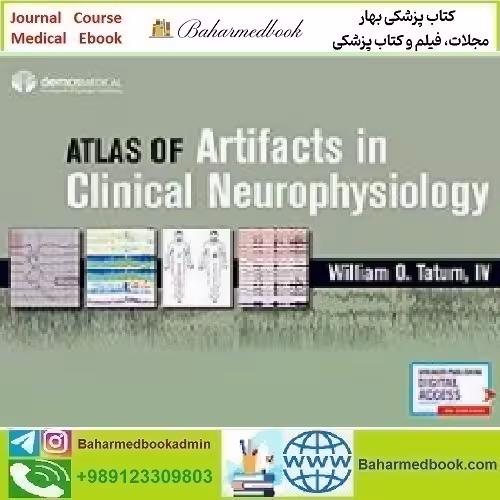 Atlas of Artifacts in Clinical Neurophysiology 2019 TRUE PD
