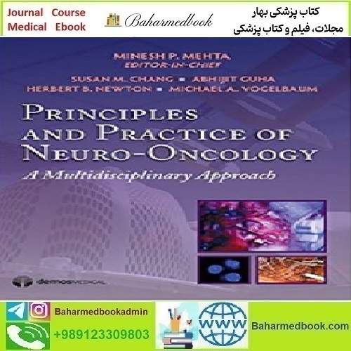 Principles &amp; Practice of Neuro oncology A Multidisciplinary Appro