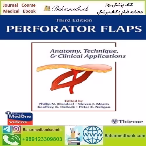 Perforator Flaps Anatomy Technique &amp; Clinical Applications 2024