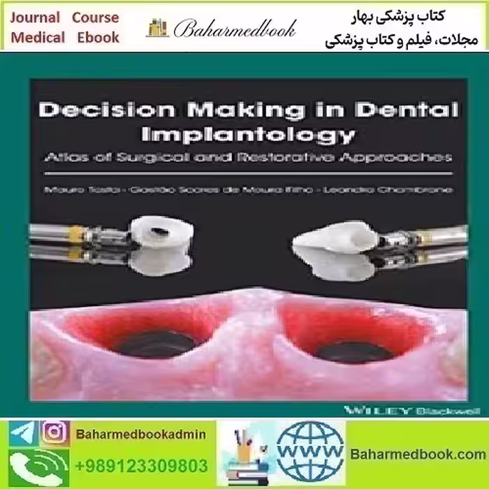 Decision Making in Dental Implantology Atlas of Surgical and Res