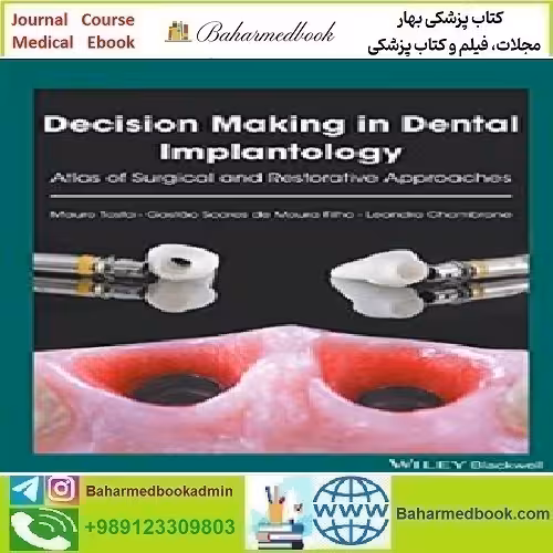 Decision Making in Dental Implantology Atlas of Surgical and Res