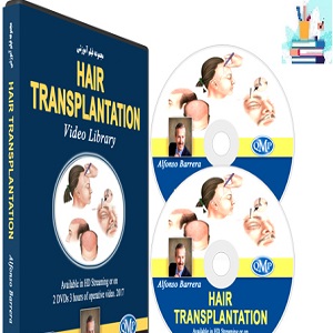 Hair Transplantation QMP-Course-Video at 10€ - کتاب پزشکی بهار