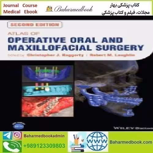 Atlas of Operative Oral and Maxillofacial Surgery 2023 TR