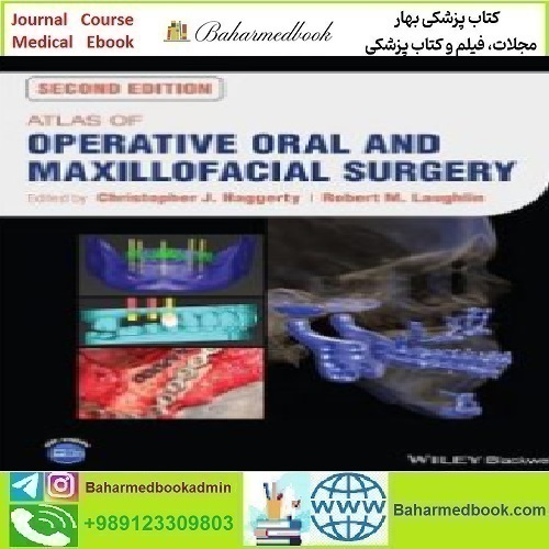 Atlas of Operative Oral and Maxillofacial Surgery 2023 TR