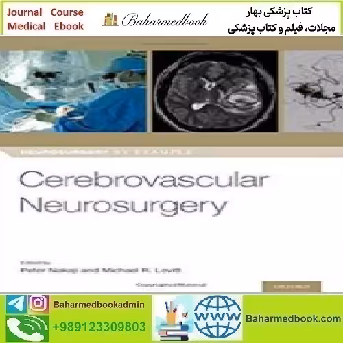 Cerebrovascular Neurosurgery 2019 TRUE PDF price 1€ - کتاب پزشکی بهار