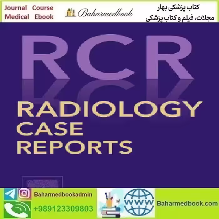 Radiology Case Reports Volume 16 Issue 1 to 12 2021 T