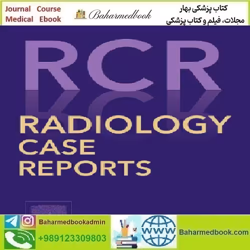 Radiology Case Reports Volume 16 Issue 1 to 12 2021 T