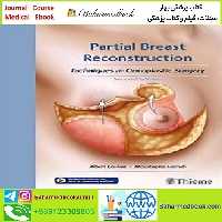 Partial Breast Reconstruction TRUE PDF price 1€ - کتاب پزشکی بهار