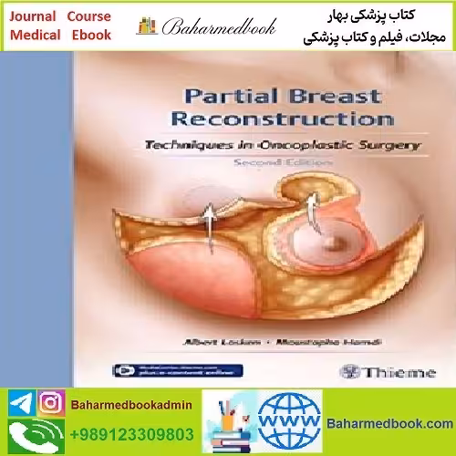 Partial Breast Reconstruction TRUE PDF price 1€ - کتاب پزشکی بهار