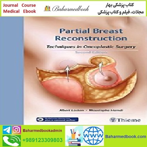 Partial Breast Reconstruction TRUE PDF price 1€ - کتاب پزشکی بهار