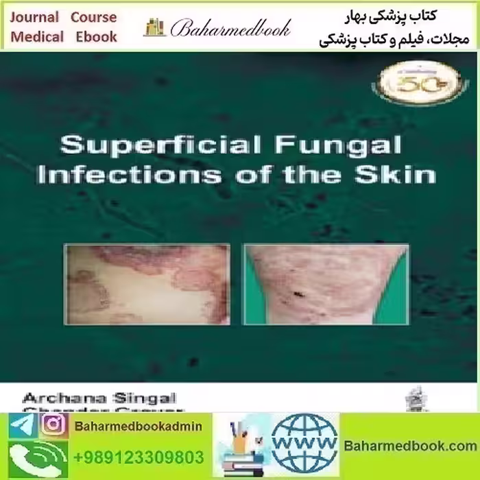 Superficial Fungal Infections of the Skin 2019 TRUE PDF price 1€ - کتاب پزشکی بهار