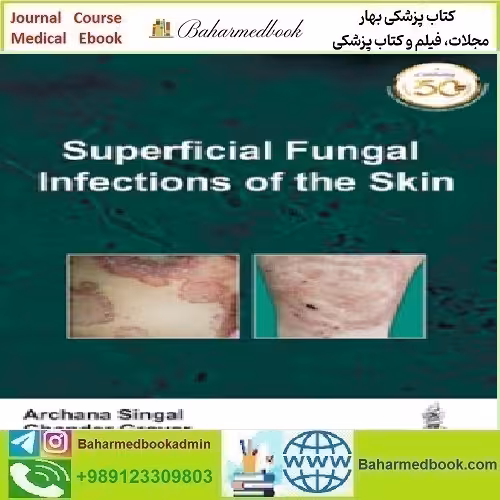 Superficial Fungal Infections of the Skin 2019 TRUE PDF price 1€ - کتاب پزشکی بهار